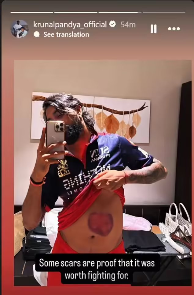 Krunal Pandya